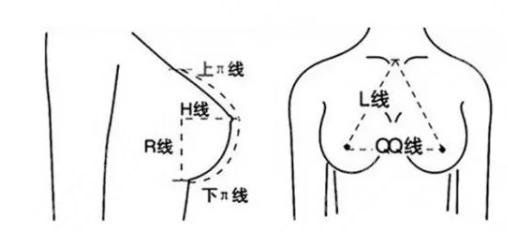 曼托豐胸