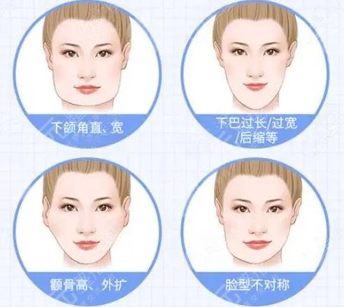 磨骨