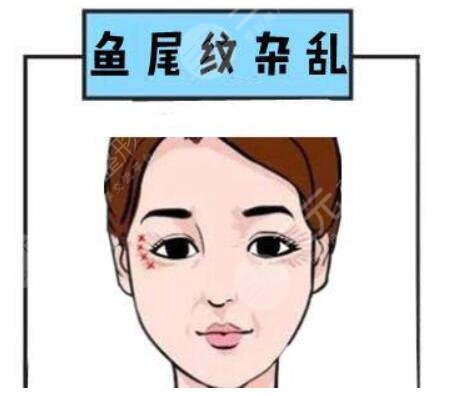 祛除魚尾紋的注意事項(xiàng)