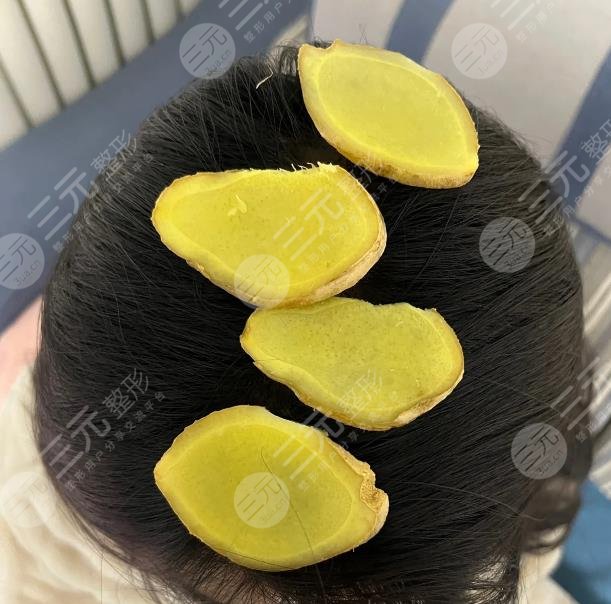 涂抹生姜