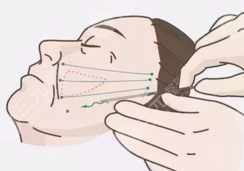 杜**醫(yī)生坐診醫(yī)院介紹:北京黃寺醫(yī)療美容診所