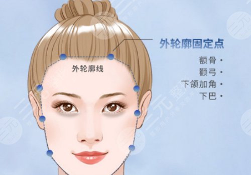 面部輪廓固定多少錢