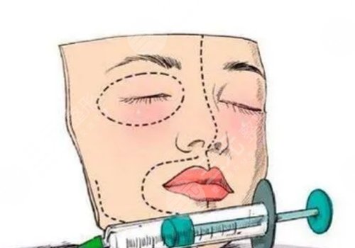 面部脂肪填充多久能恢復(fù)自然？