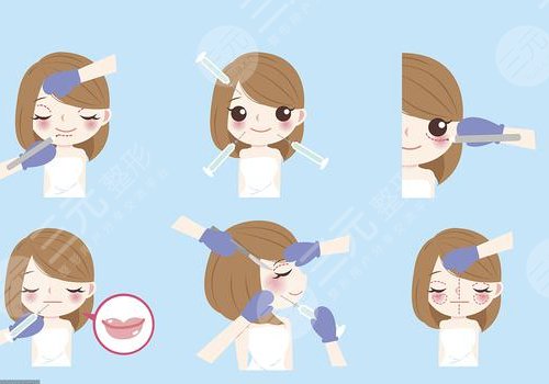 微調(diào)整形有風(fēng)險(xiǎn)嗎？