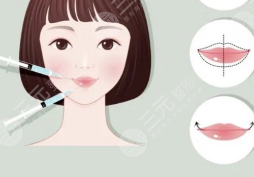 微調(diào)整形有風(fēng)險(xiǎn)嗎？