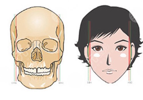 面部輪廓整形包括哪些項目？