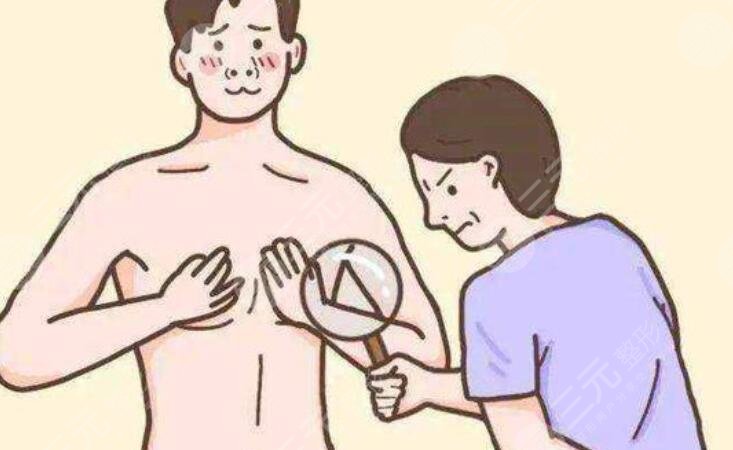 男性胸部吸脂多少錢？手術費用價格表匯總！3家正規(guī)醫(yī)院介紹~