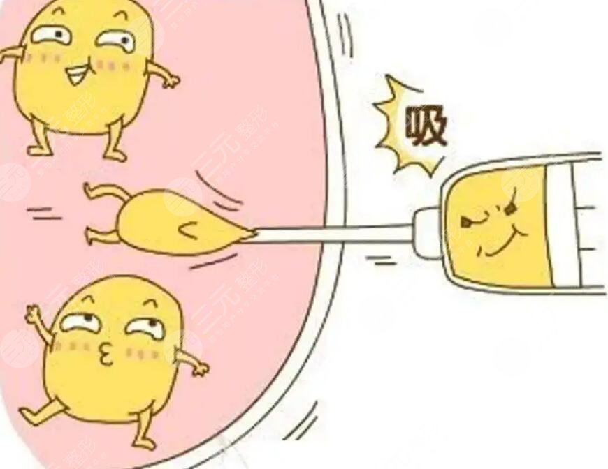 手臂吸脂