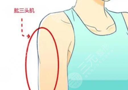 手臂吸脂