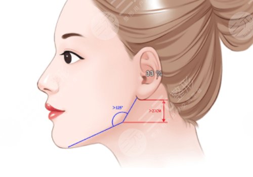 面部輪廓整形有什么后遺癥？