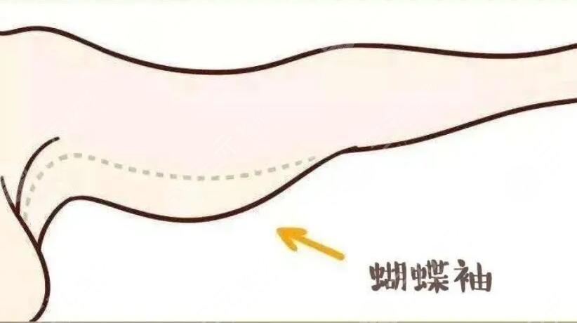 蝴蝶袖