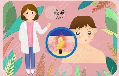 閉合性粉刺怎么徹底去除