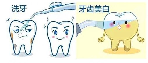 冷光牙齒美白的幾個(gè)步驟是什么?