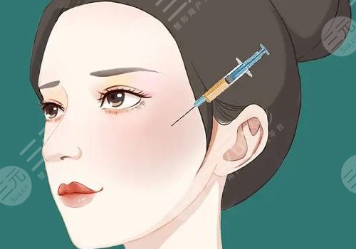 面部輪廓整形包括哪些種類(項目)？