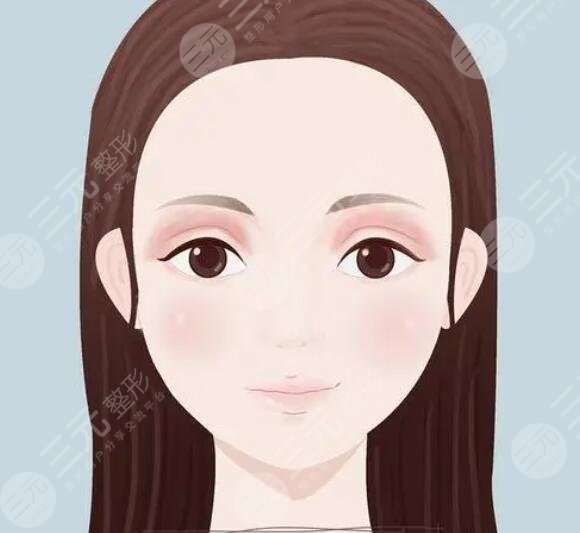 埋線雙眼皮