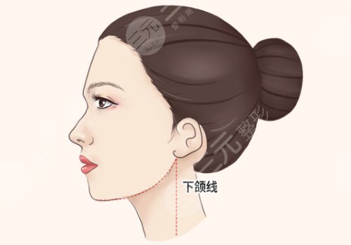 影響輪廓整形價(jià)格的因素有哪些?