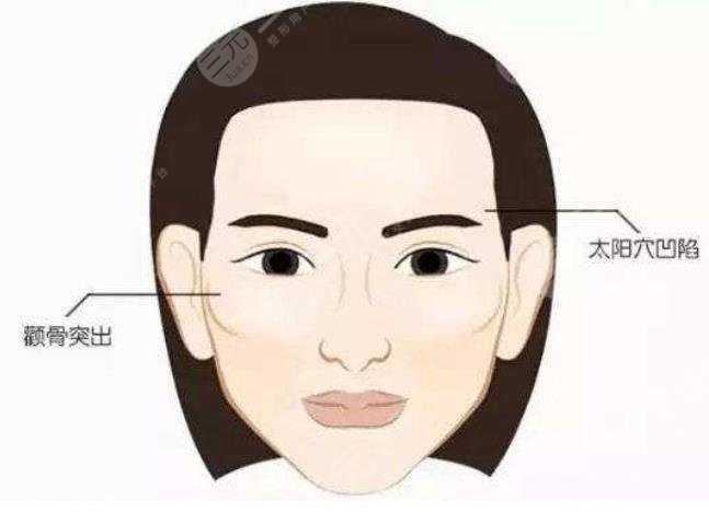 顴骨