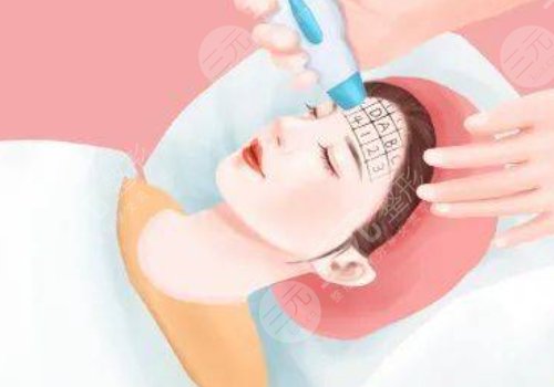 微調(diào)整形都有什么項(xiàng)目？