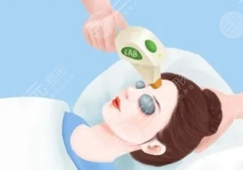 微調(diào)整形都有什么項(xiàng)目？