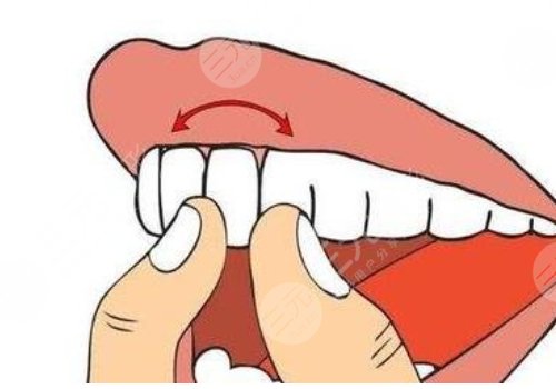 吳中興醫(yī)生審美怎么樣?