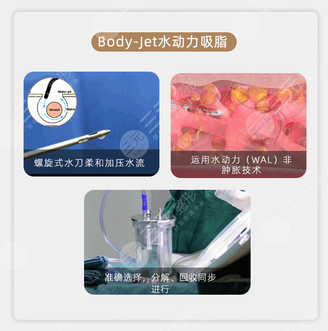 蝴蝶袖手臂吸脂多少錢？價格費用更新！3家優(yōu)質(zhì)機構(gòu)分享~