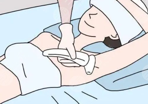 激光脫毛和冰點脫毛哪個好？