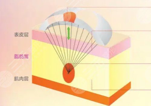 半島黃金微雕和進(jìn)口的黃金微雕哪個(gè)好？