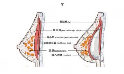 強(qiáng)生傲諾拉和曼托區(qū)別在哪？