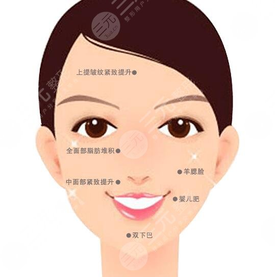 宋延剛面吸怎么樣？醫(yī)生實(shí)力測評公開，親身體驗(yàn)面部吸脂細(xì)節(jié)！