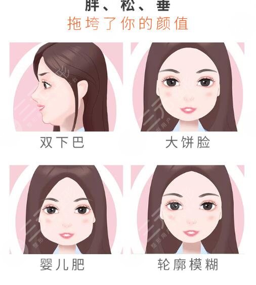 宋延剛醫(yī)生面吸案例分享