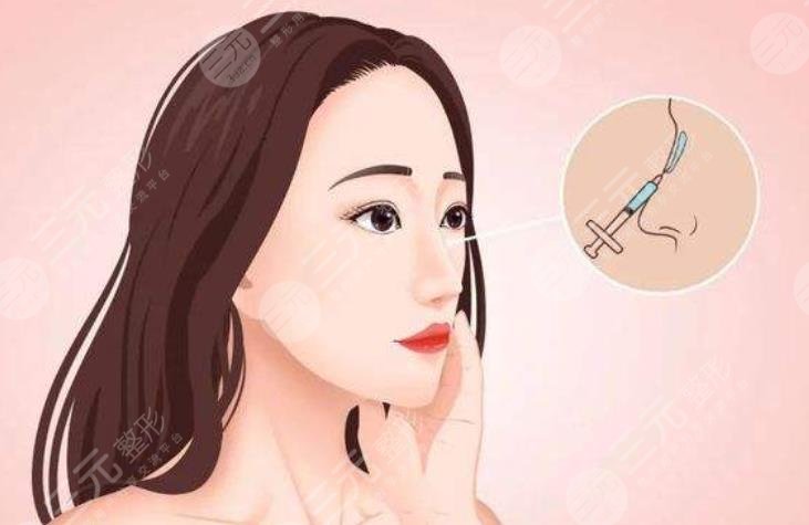 大鼻子整形一般多少錢