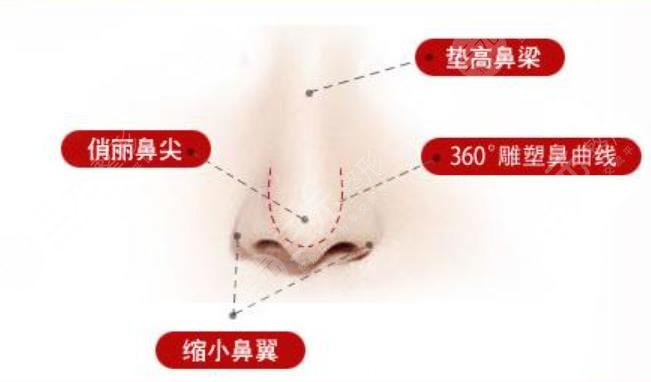 鼻綜合