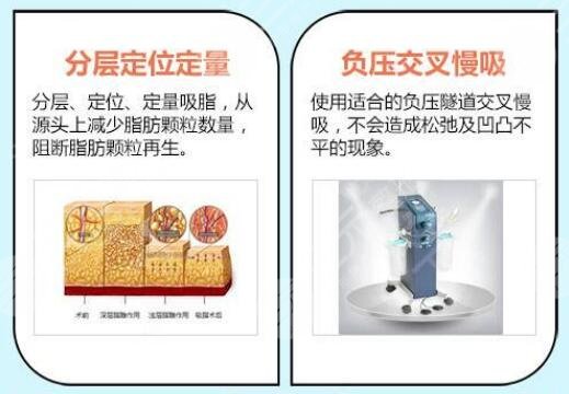 大腿吸脂