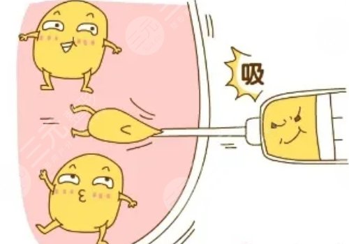 濟(jì)南韓式和濟(jì)南藝星哪個(gè)好?