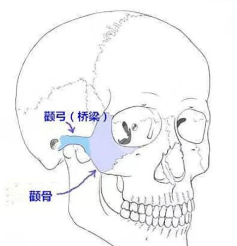 微創(chuàng)顴骨整形手術(shù)后注意事項(xiàng)有哪些?