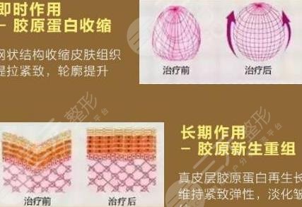 熱瑪吉