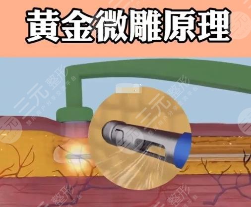 黃金微雕
