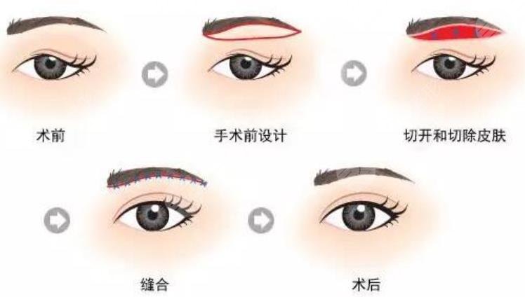 切眉