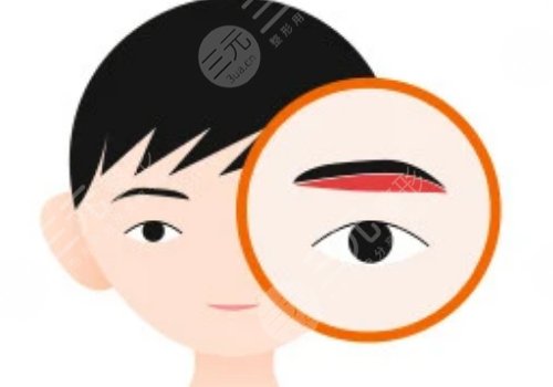 提眉的好處和壞處有什么？