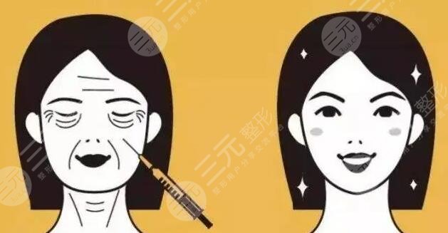 雙燕尾拉皮手術維持時間