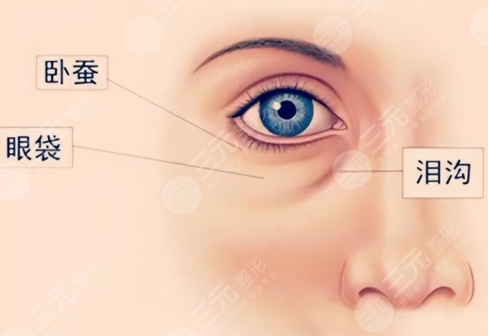 下眼瞼切除手術(shù)
