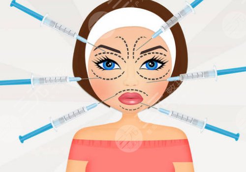 輪廓針可以打哪些地方？