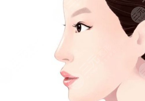 北京上上相醫(yī)療美容診所脂肪隆鼻怎么樣？