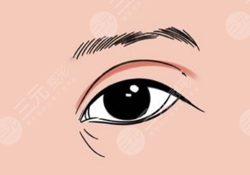 幼態(tài)臉需要做哪些整形項(xiàng)目？