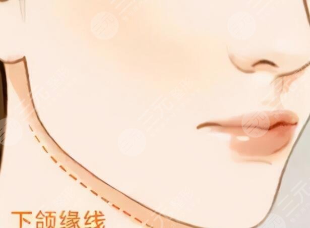下頜緣提升效果圖前后對比，你和明星的差距就只差一個下頜線~