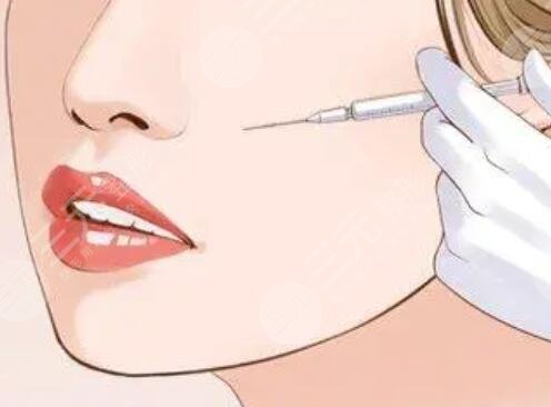 下頜緣提升介紹