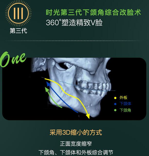 杭州時(shí)光醫(yī)療美容醫(yī)院是三甲嗎，技術(shù)怎么樣？測(cè)評(píng)報(bào)告&價(jià)格一覽！