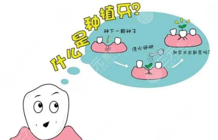 牙齒種植