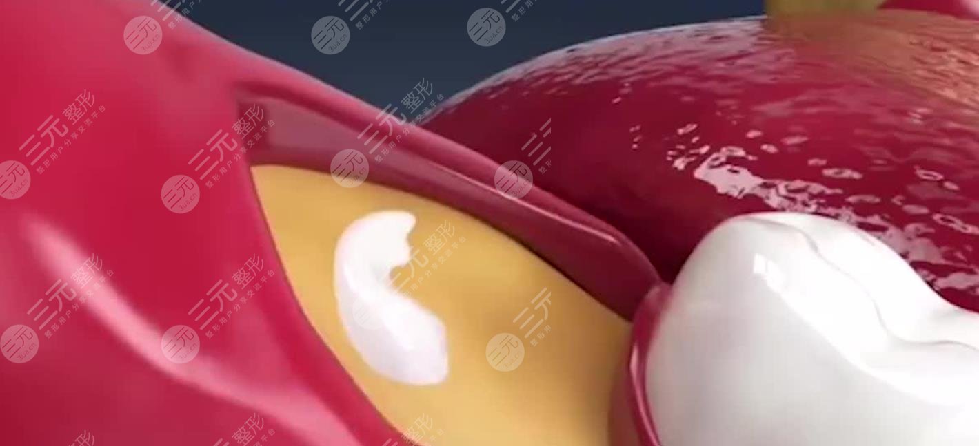 拔牙