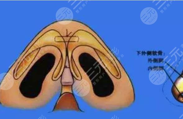 鼻頭縮小